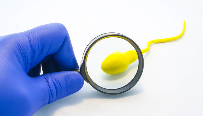 Demystifying Semen Analysis: A Comprehensive Guide to Male Fertility Assessment