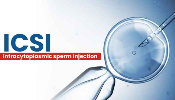 Intracytoplasmic Sperm Injection