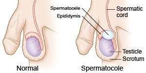 Pain disorders in Urology