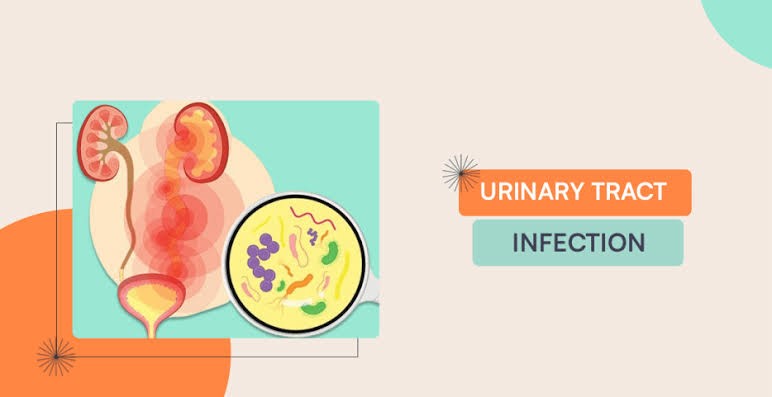 Understanding Urinary Tract Infections (UTIs): Causes, Symptoms, and Treatment